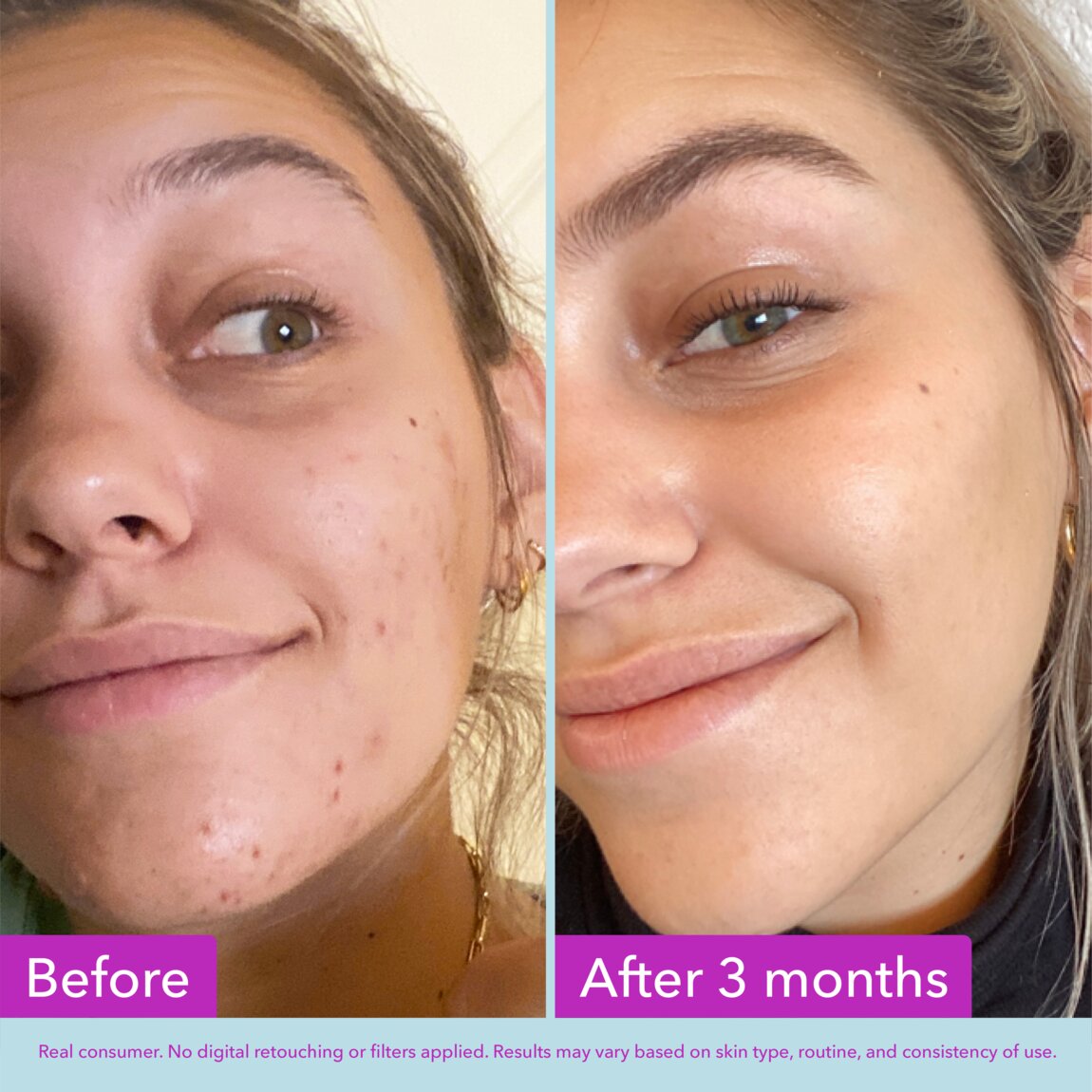 niacinamide-brightening-toner-h9 zb_p.jpg