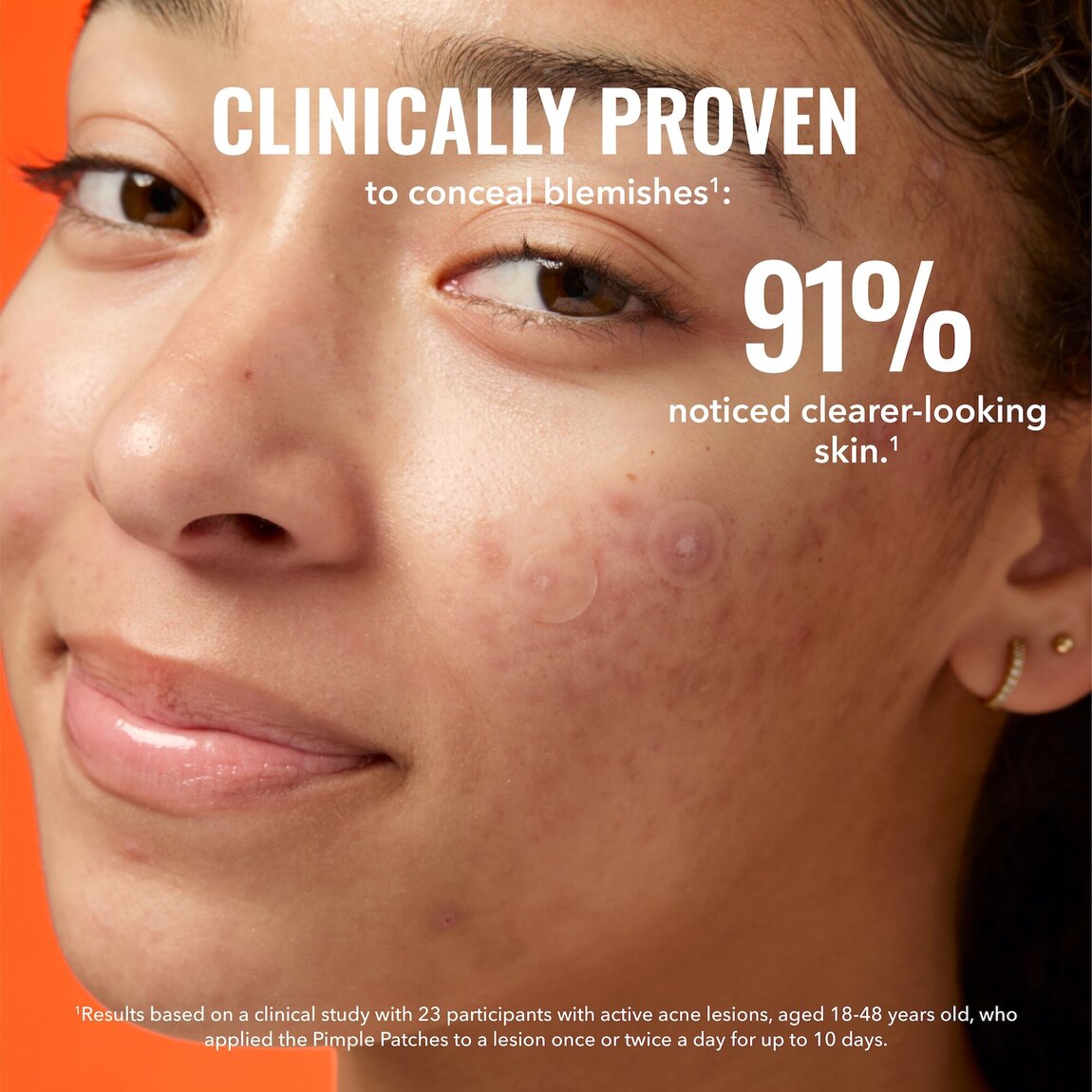 pimple-patches-f2 zb_p.jpg